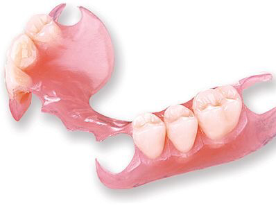 Prótesis dental confeccionada a medida en el consultorio